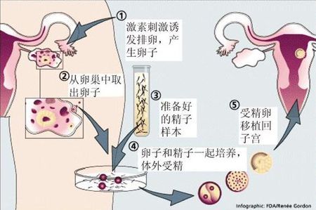 时差成像